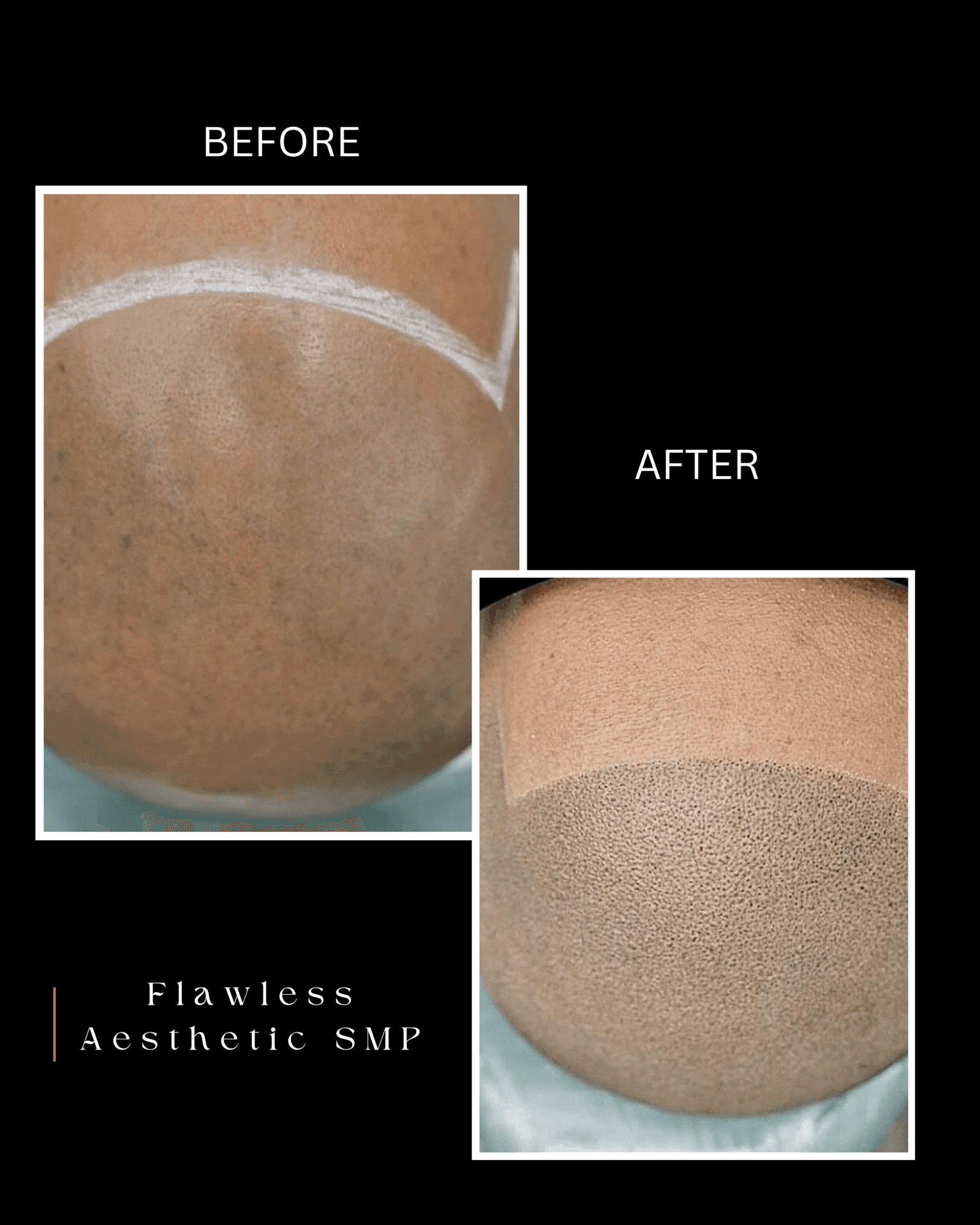 Personalized Aesthetic Consultations